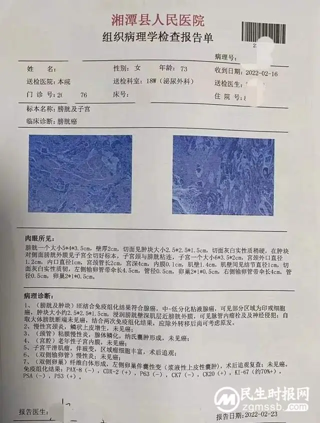 泌尿外科腔镜技术帮患者告别“蜈蚣”疤