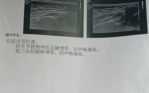 【中医·医者红】锦旗的故事：“毛主席家乡的中医院骨伤科真是棒！”