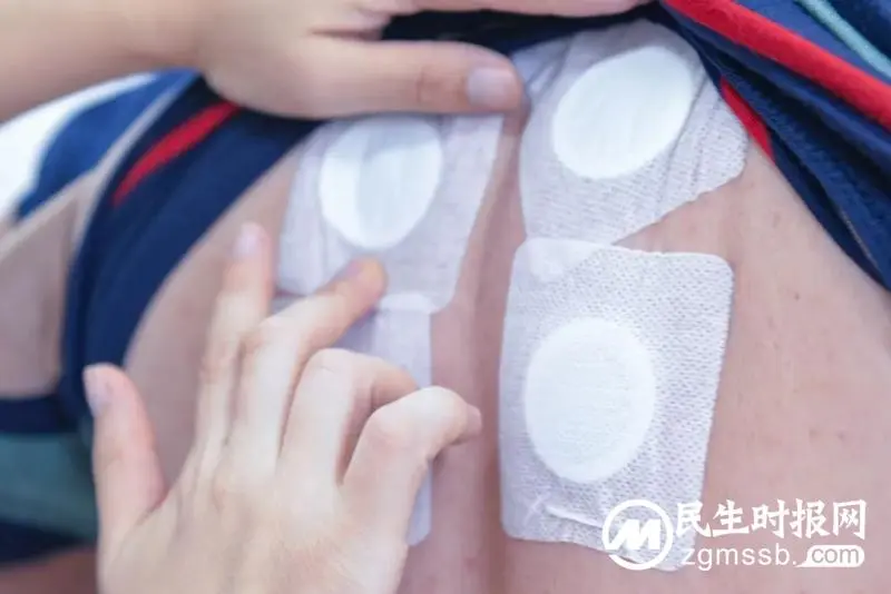 首个贴敷日,你贴了吗? 首个贴敷日,你贴了吗?