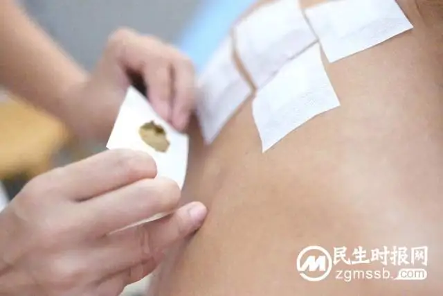 湘潭市中医医院“冬病夏治”三伏贴又开贴：专业、专注、专属，传统、地道、有效