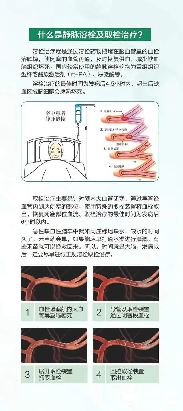 【世界卒中日】不让卒中“卒”不及防