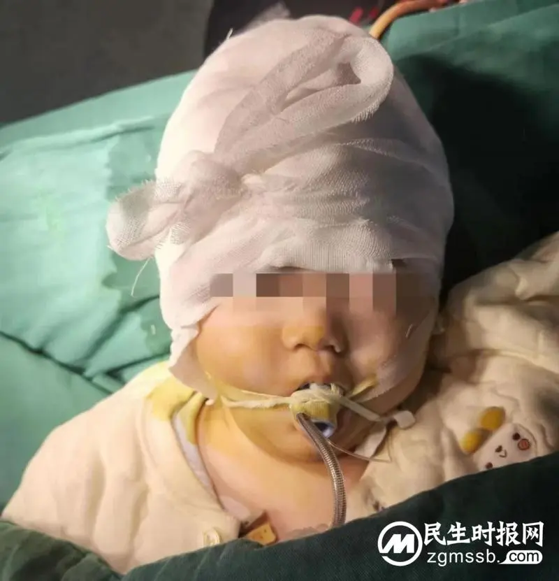 【中心医院·医者红】关爱儿童,谨防摔落!湘潭市中心医院一例重型颅脑伤患儿抢救纪实 【中心医院·医者红】关爱儿童,谨防摔落!湘潭市中心医院一例重型颅脑伤患儿抢救纪实