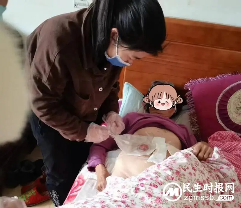 “造口之家”将温暖与关爱送到患者家中