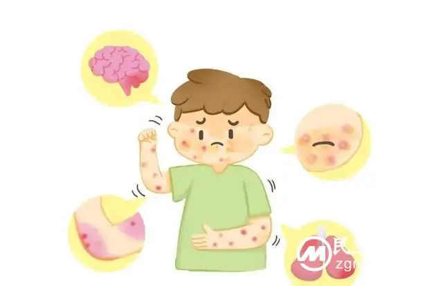 世界艾滋病日|共抗艾滋 共享健康 世界艾滋病日|共抗艾滋 共享健康