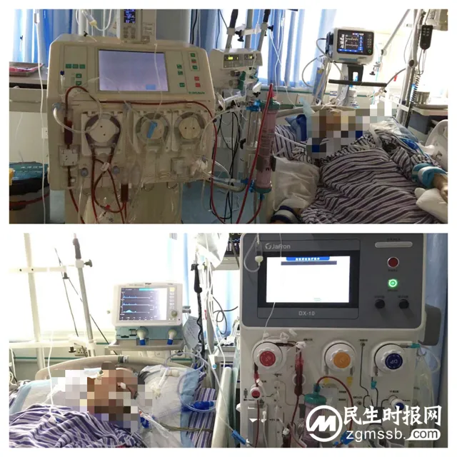 危重病人的生命支持技术法宝之——连续性床旁血液滤过（CRRT）