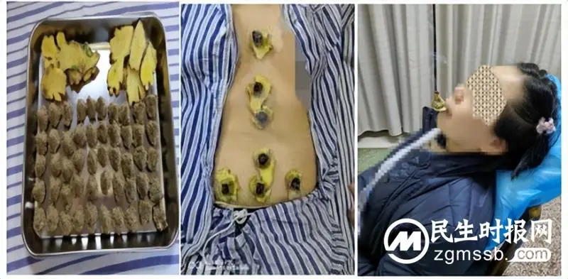 【中医药文化】治疗新冠后遗症，中医外治显疗效