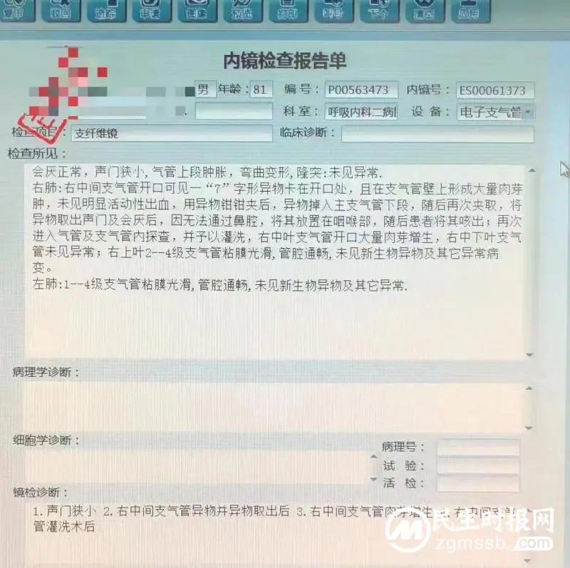 81岁老人长达半年呼吸不畅,罪魁祸首竟然是…… 81岁老人长达半年呼吸不畅,罪魁祸首竟然是……