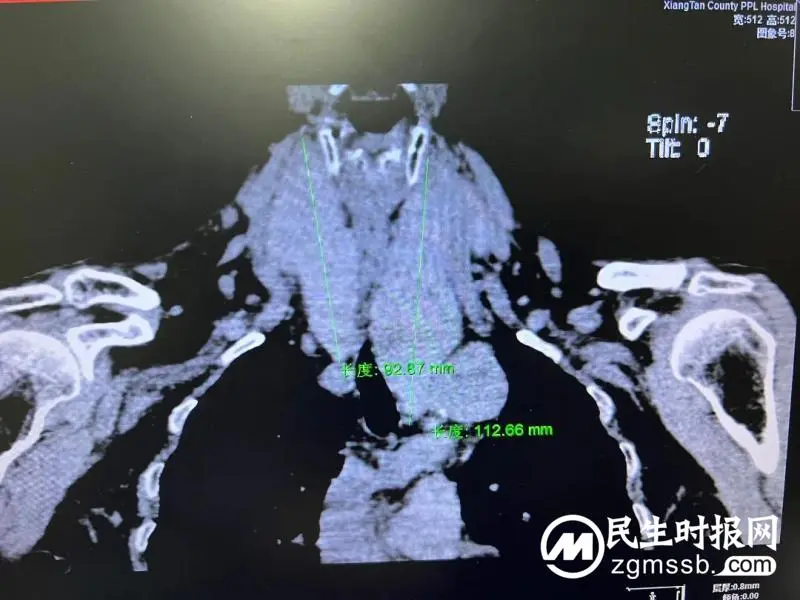 经历了这场大战后,我终于明白了一个道理...... 经历了这场大战后,我终于明白了一个道理......