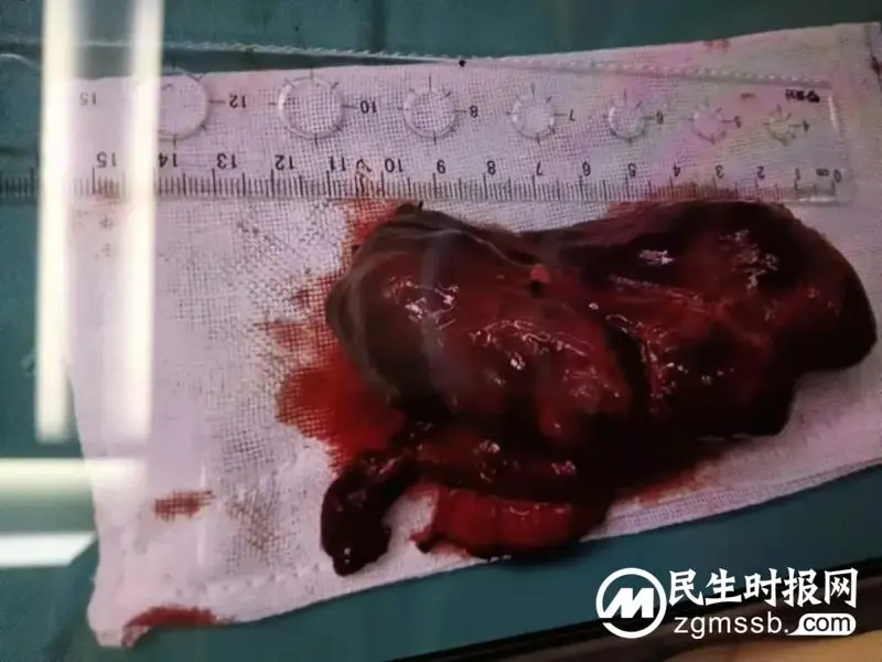 经历了这场大战后,我终于明白了一个道理...... 经历了这场大战后,我终于明白了一个道理......