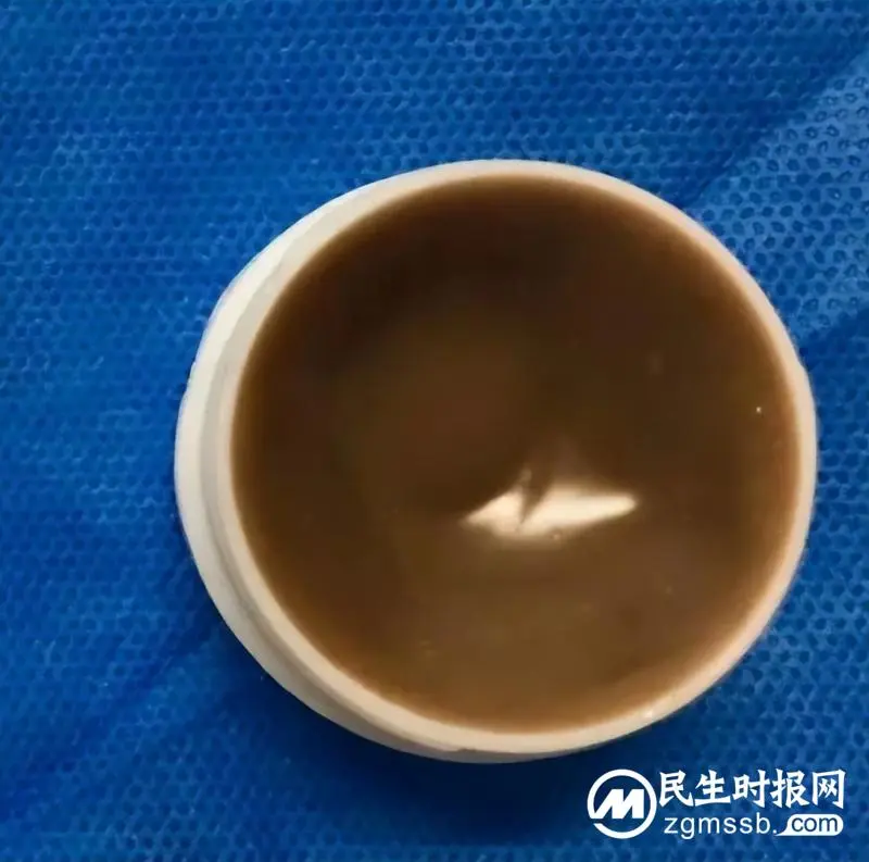 省级中医重点专科 -- 肛肠科 | 小小肛肠科,为何短时间内网络点击量能突破1000万? 省级中医重点专科 -- 肛肠科 | 小小肛肠科,为何短时间内网络点击量能突破1000万?