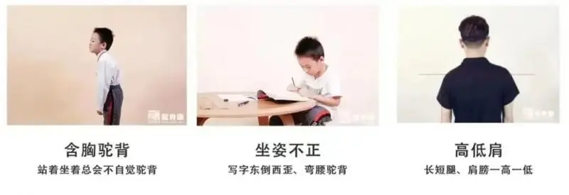 湘潭县中医医院脊柱侧弯筛查开始啦! 湘潭县中医医院脊柱侧弯筛查开始啦!