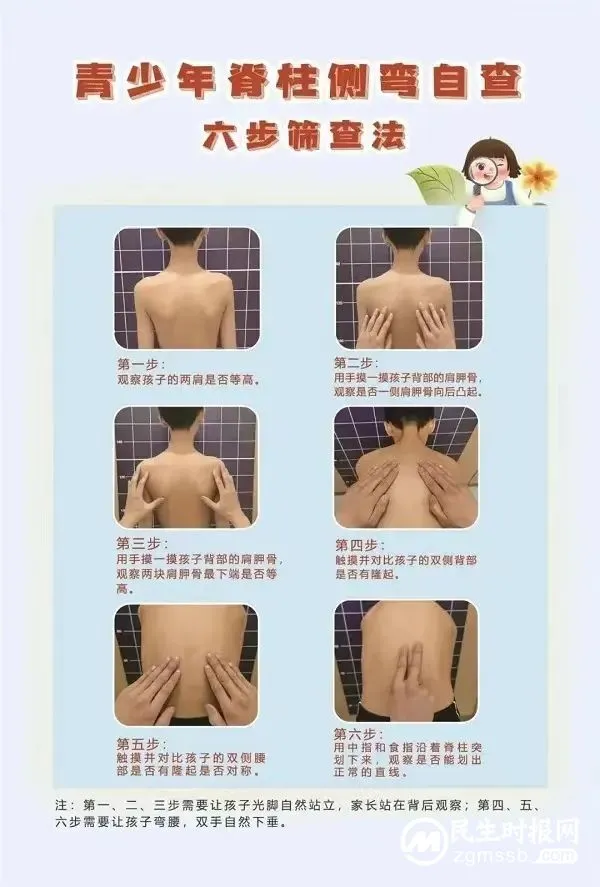 湘潭县中医医院脊柱侧弯筛查开始啦! 湘潭县中医医院脊柱侧弯筛查开始啦!