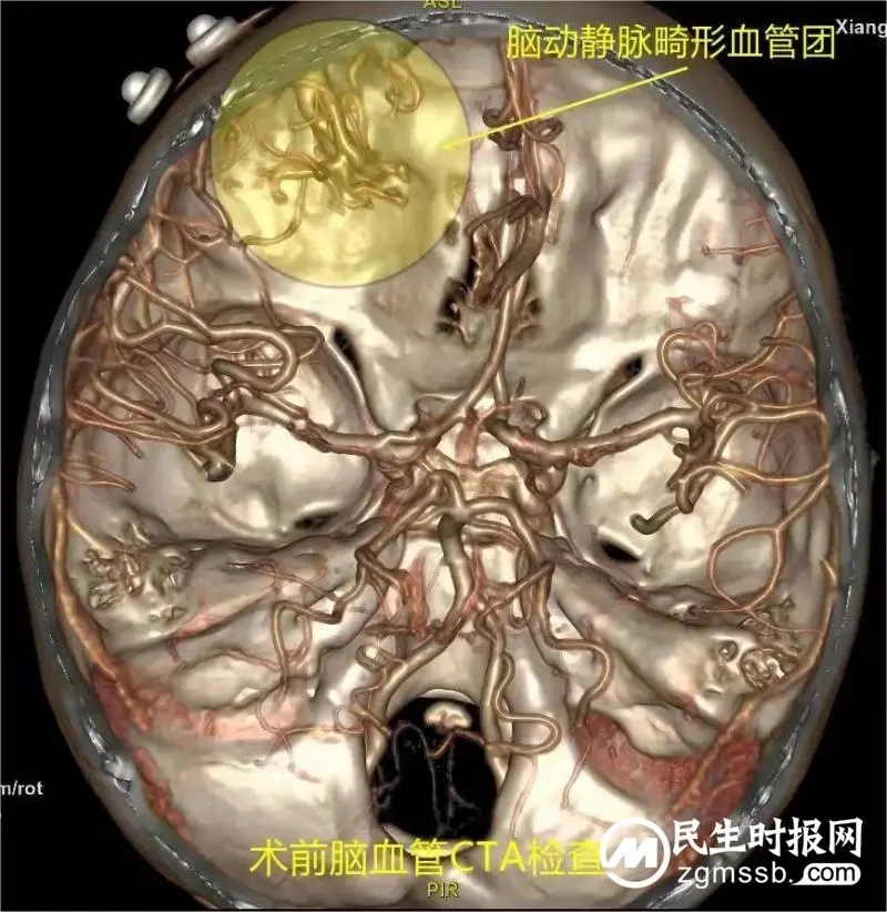 显微镜下的精工匠,记录七岁女童“历险记” 显微镜下的精工匠,记录七岁女童“历险记”
