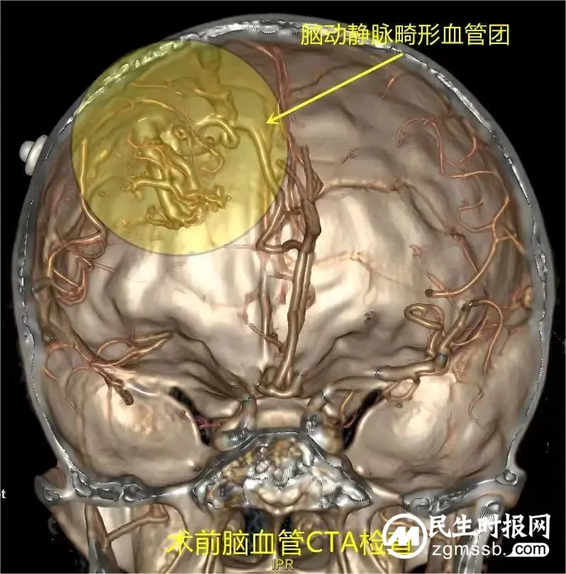 显微镜下的精工匠,记录七岁女童“历险记” 显微镜下的精工匠,记录七岁女童“历险记”