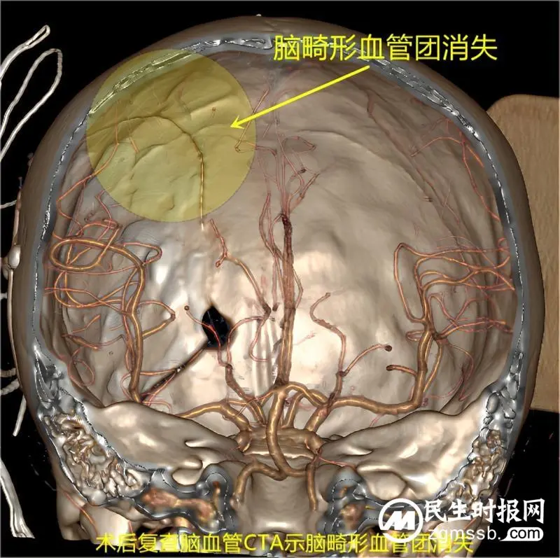显微镜下的精工匠,记录七岁女童“历险记” 显微镜下的精工匠,记录七岁女童“历险记”