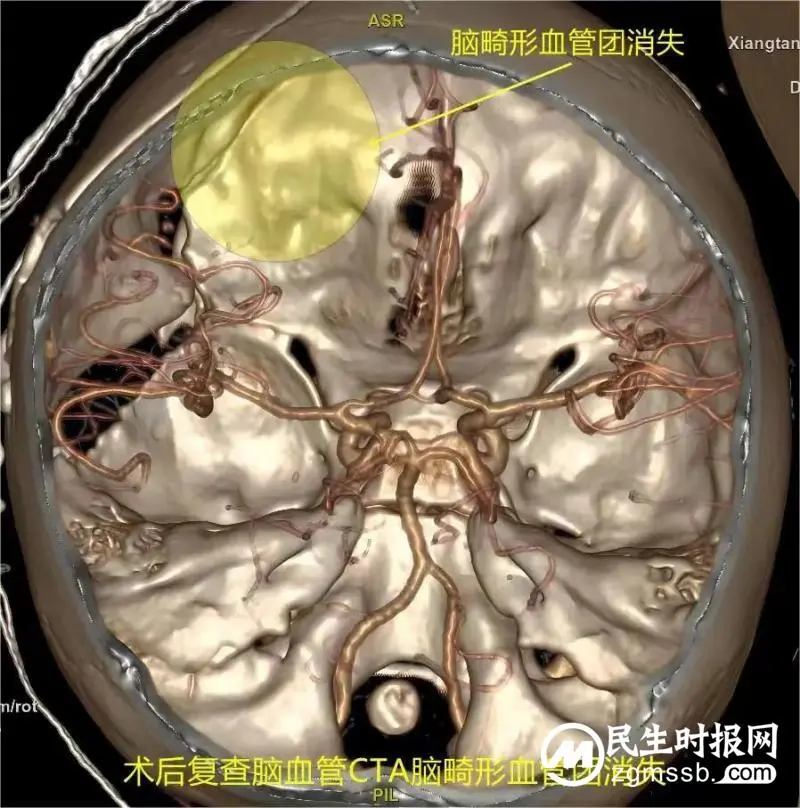 显微镜下的精工匠,记录七岁女童“历险记” 显微镜下的精工匠,记录七岁女童“历险记”