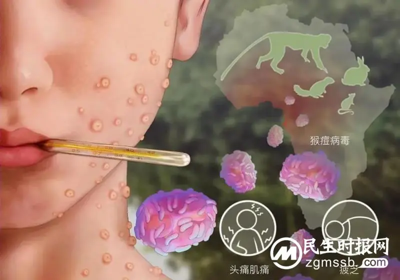 都在说猴痘，猴痘是什么？如何预防？