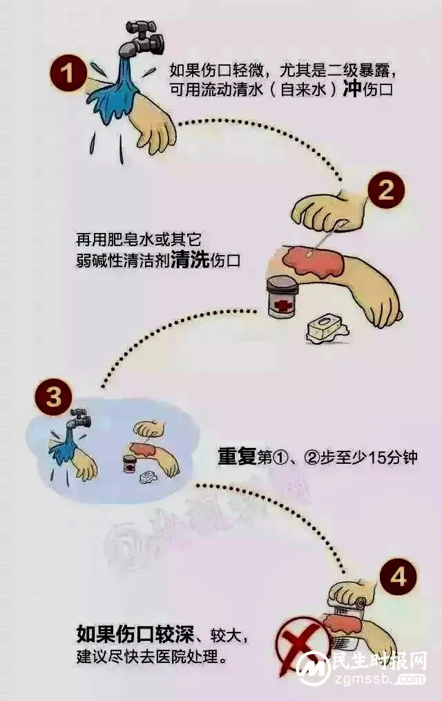 你需要了解致死率100%的狂犬病知识点