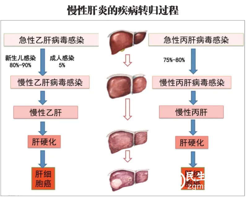 关于做好2023年“世界肝炎日”主题宣传活动的通知 关于做好2023年“世界肝炎日”主题宣传活动的通知