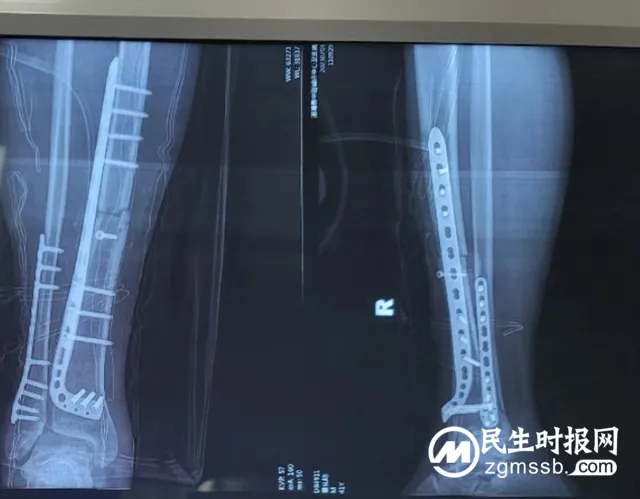 【莲乡卫健党旗红】走近“第一书记”——湘潭县人民医院王彪、蔡智、左磊