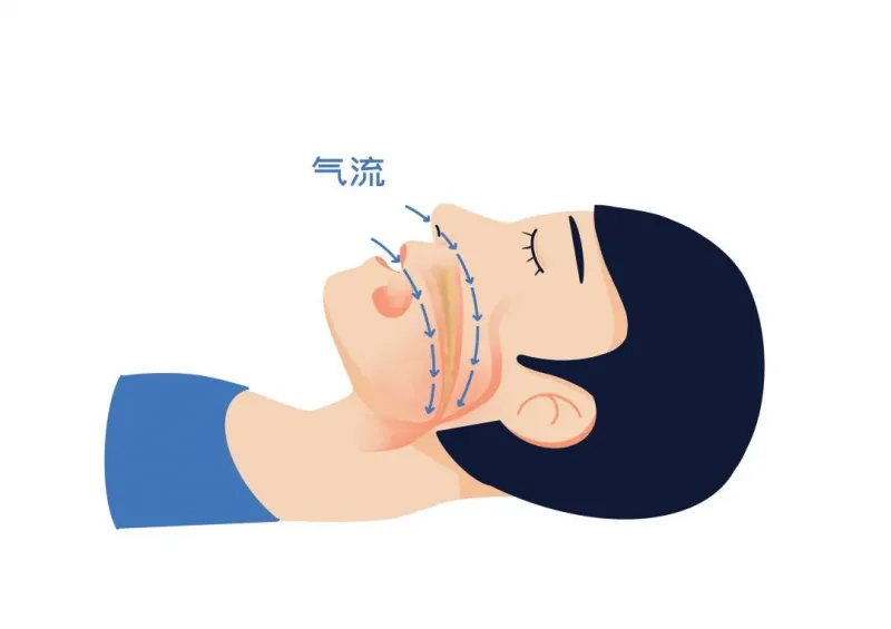 打呼噜如果有这几个特点,需要重视了! 打呼噜如果有这几个特点,需要重视了!