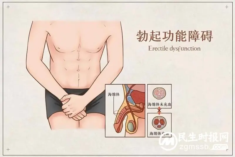 【医学科普】浅谈“男”言之隐--勃起功能障碍