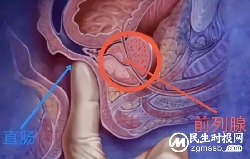 【医学科普】让人羞羞的“肛门指检”竟能查出这么多病? 【医学科普】让人羞羞的“肛门指检”竟能查出这么多病?
