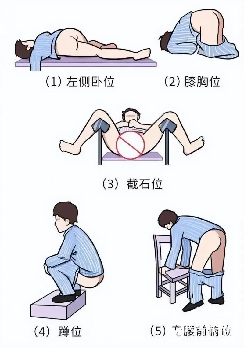 【医学科普】让人羞羞的“肛门指检”竟能查出这么多病? 【医学科普】让人羞羞的“肛门指检”竟能查出这么多病?