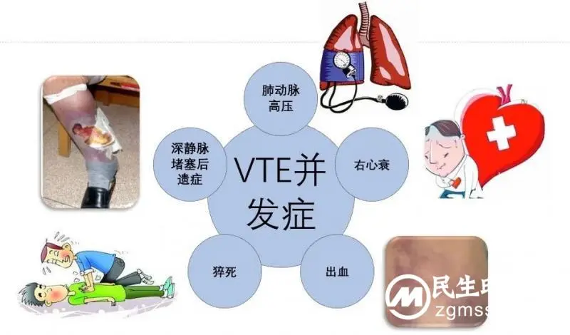 【卓越护理】医患携手,预防VTE 【卓越护理】医患携手,预防VTE