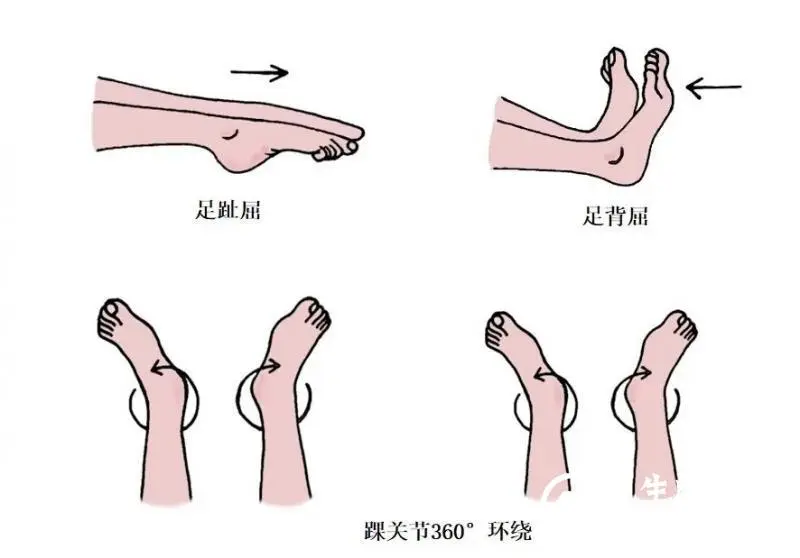 【卓越护理】医患携手,预防VTE 【卓越护理】医患携手,预防VTE