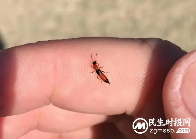 男子皮肤多处溃烂,只因随手捏死一只虫子..... 男子皮肤多处溃烂,只因随手捏死一只虫子.....