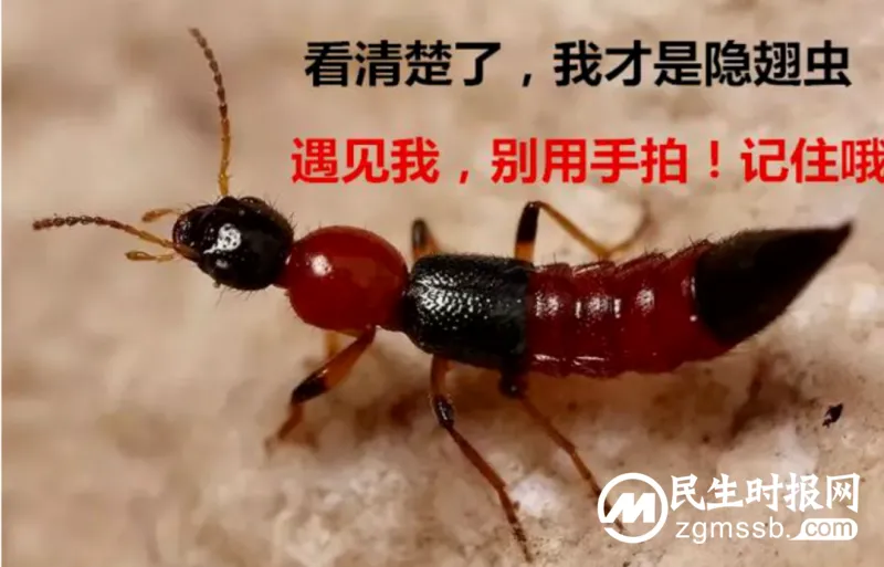 男子皮肤多处溃烂,只因随手捏死一只虫子..... 男子皮肤多处溃烂,只因随手捏死一只虫子.....