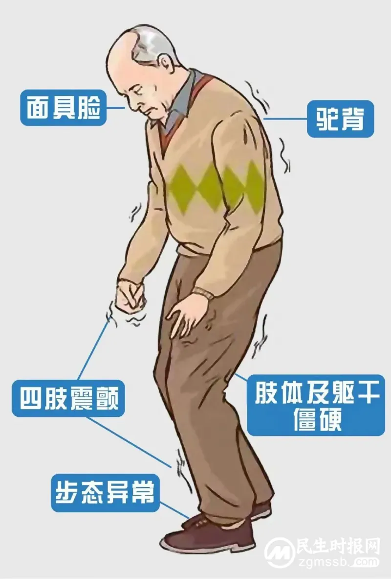 湘潭县人民医院帕金森专病门诊开诊 湘潭县人民医院帕金森专病门诊开诊