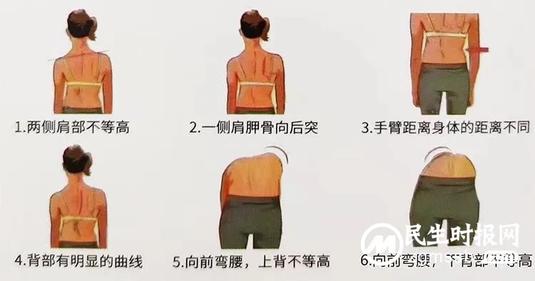 寒假怎么过?2024年脊柱侧弯及不良体态矫正冬令营开班啦! 寒假怎么过?2024年脊柱侧弯及不良体态矫正冬令营开班啦!