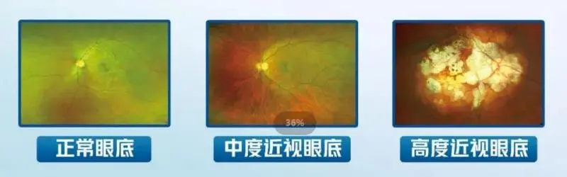 你有一份“寒假视力守护指南”，请注意查收