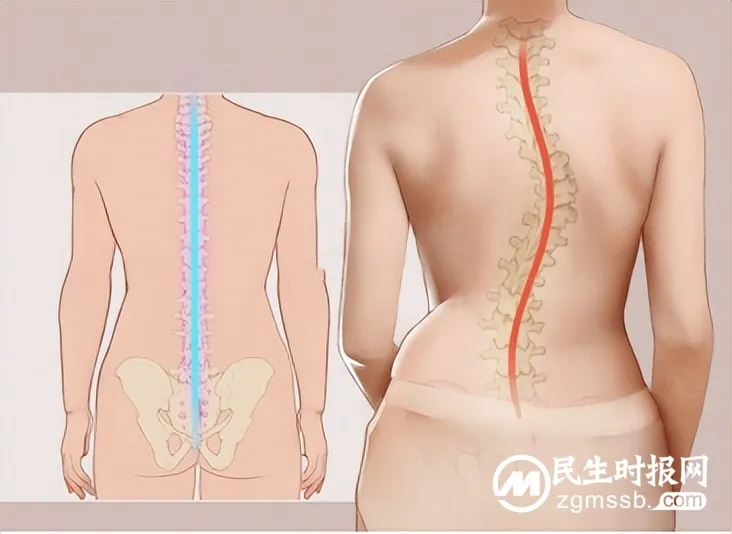 【义诊预告】儿童、青少年扁平足、脊柱侧弯免费筛查义诊活动来了! 【义诊预告】儿童、青少年扁平足、脊柱侧弯免费筛查义诊活动来了!