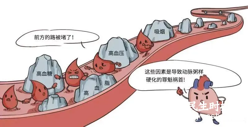 撑起“一线天”:颈内动脉狭窄血管支架置入术 撑起“一线天”:颈内动脉狭窄血管支架置入术