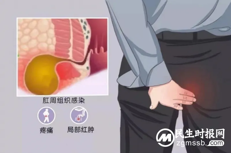 你的“小菊花”还好吗? 你的“小菊花”还好吗?