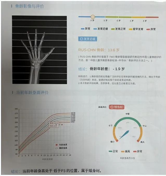 父母忙于工作忽视致15岁女儿终身高仅1米4,骨骺线闭合! 父母忙于工作忽视致15岁女儿终身高仅1米4,骨骺线闭合!