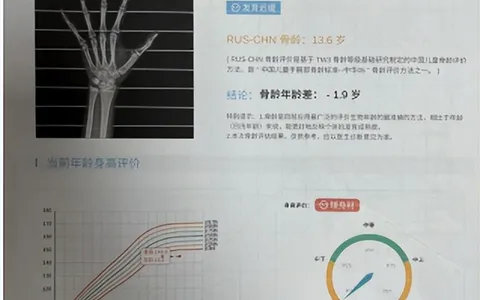 父母忙于工作忽视致15岁女儿终身高仅1米4，骨骺线闭合！