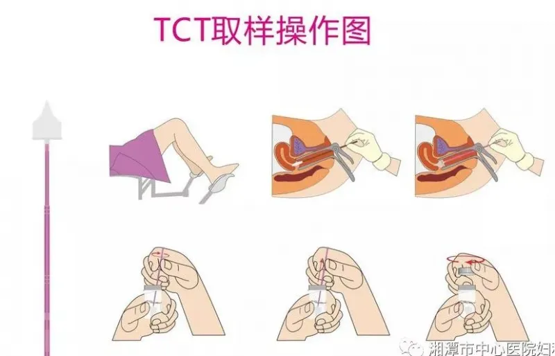 宫颈癌筛查及HPV知识,你想知道的都在这里! 宫颈癌筛查及HPV知识,你想知道的都在这里!