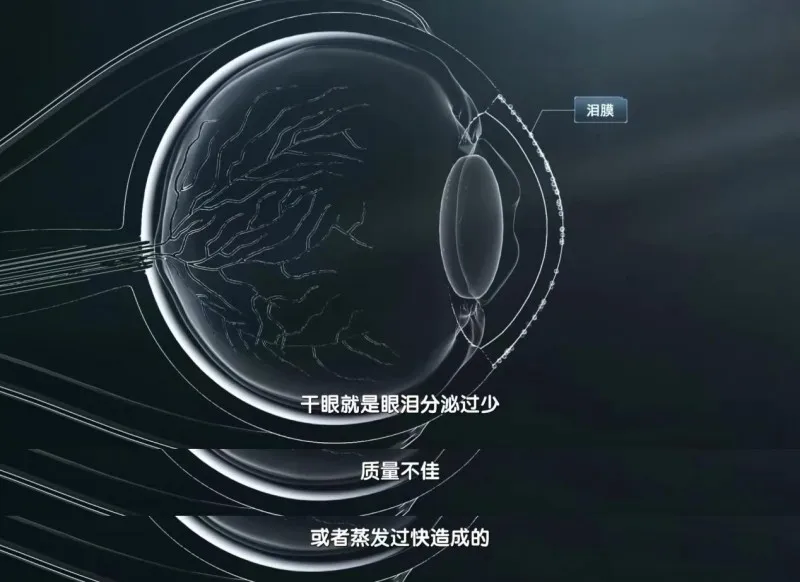 最精密的相机为什么比不过人眼?这部高分纪录片告诉你真相 最精密的相机为什么比不过人眼?这部高分纪录片告诉你真相