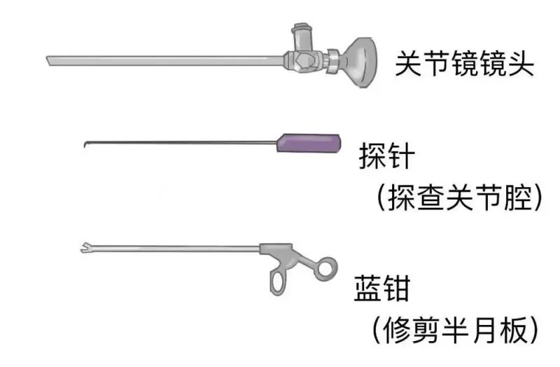 你敢信?膝关节骨折,术后仅三天就出院 你敢信?膝关节骨折,术后仅三天就出院