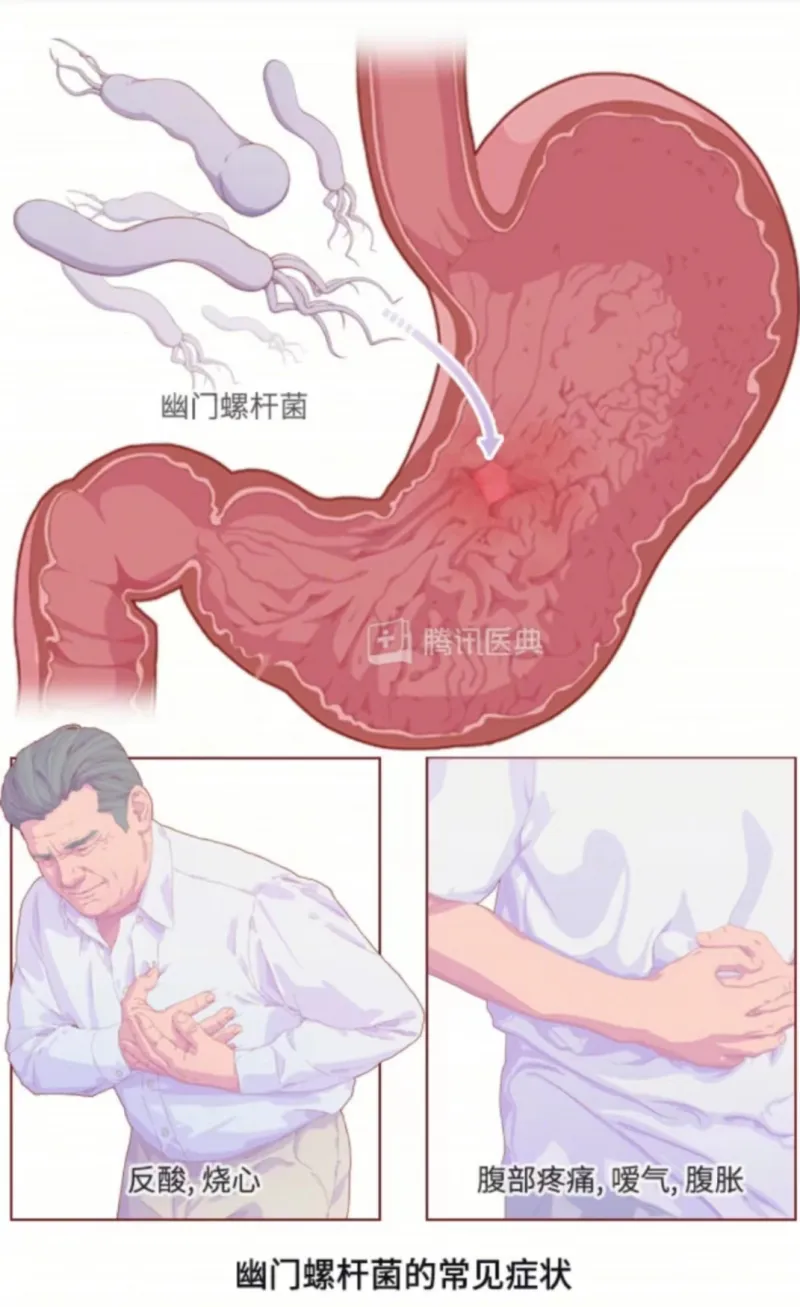 【中心医院·医者红】口臭,可能是因为...... 【中心医院·医者红】口臭,可能是因为......