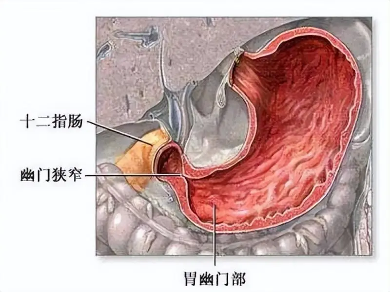 心疼!1个月宝宝像个“小老头”,原因竟是… 心疼!1个月宝宝像个“小老头”,原因竟是…