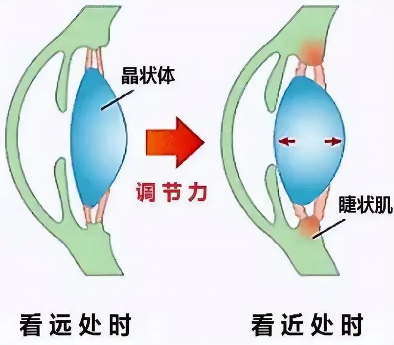 科学防控近视要区分“真”与“假” 科学防控近视要区分“真”与“假”