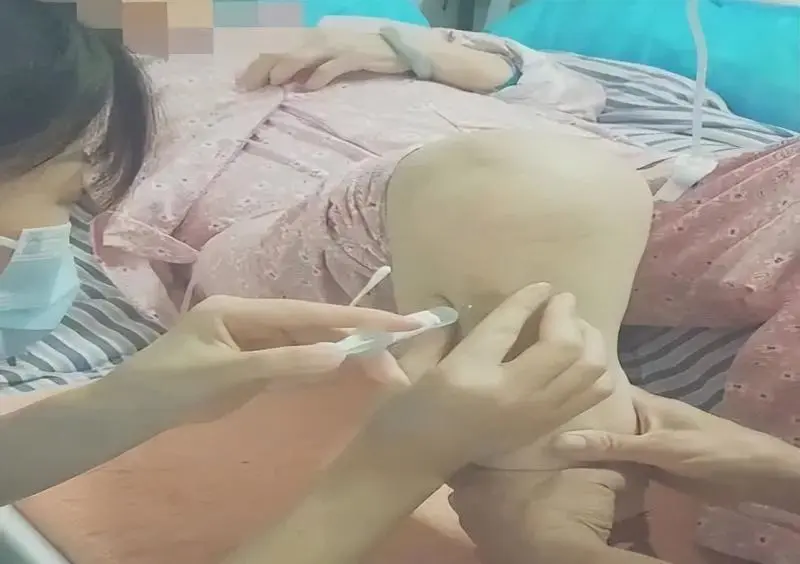 【中医·医者红】“年龄不是问题”——中西结合为82岁急性脑梗患者保驾护航 【中医·医者红】“年龄不是问题”——中西结合为82岁急性脑梗患者保驾护航