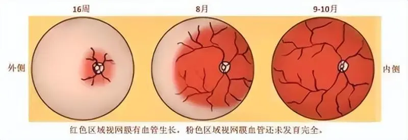 【中心医院·医者红】厉害了!他们居然在早产儿宝宝眼睛上“打针”! 【中心医院·医者红】厉害了!他们居然在早产儿宝宝眼睛上“打针”!