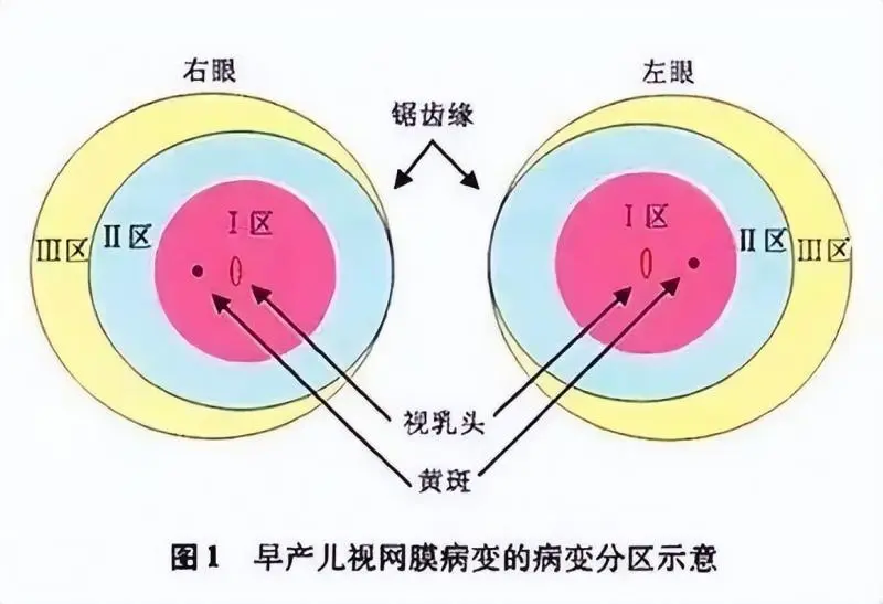 【中心医院·医者红】厉害了!他们居然在早产儿宝宝眼睛上“打针”! 【中心医院·医者红】厉害了!他们居然在早产儿宝宝眼睛上“打针”!