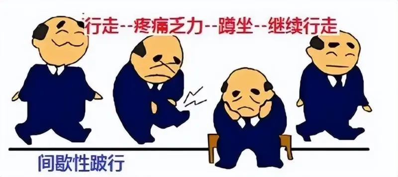 走不动、走不远?UBE微创技术,为腰椎管狭窄患者重塑行走之路 走不动、走不远?UBE微创技术,为腰椎管狭窄患者重塑行走之路